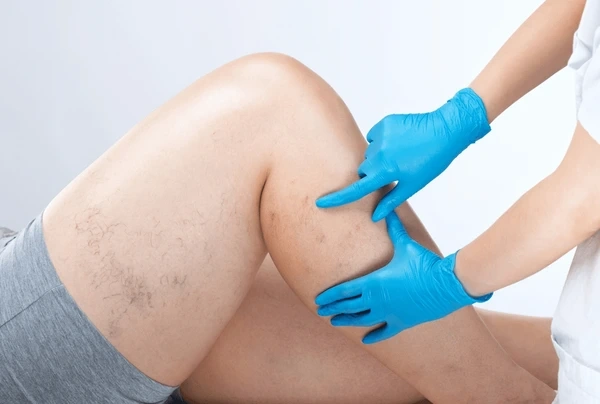 arterial ulcer treatment near you