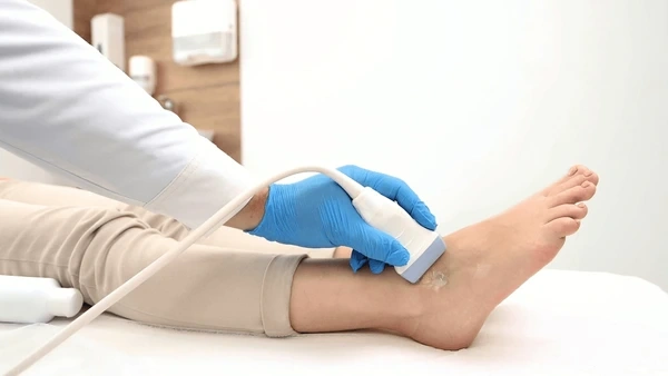 circulation and vascular assessments in upland, ca
