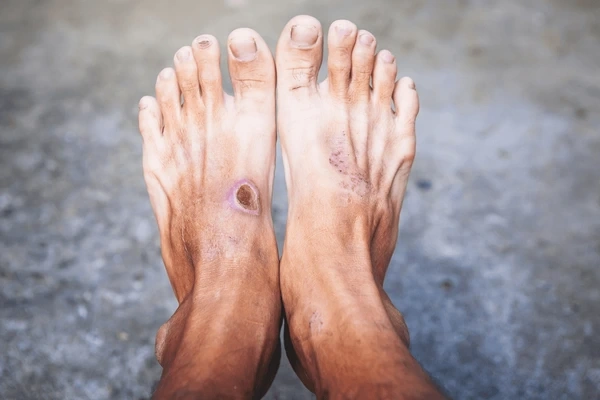diabetic limb preservation near you