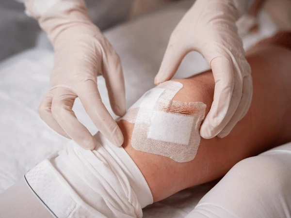 incision care in upland, ca