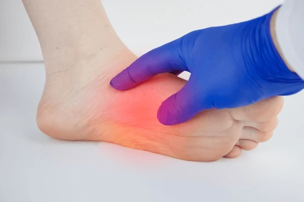 pressure ulcer (bedsore) treatment in upland, ca