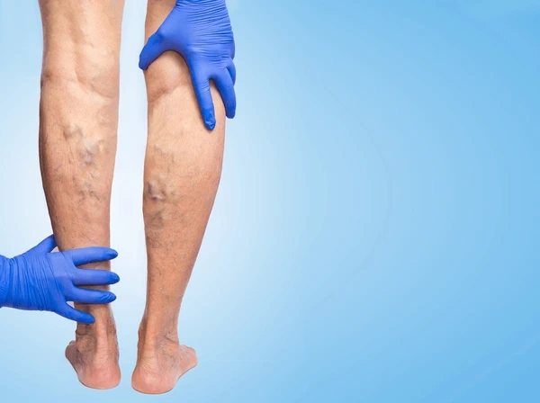 vascular testing in upland, ca